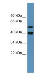 DDB2 Antibody - DDB2 antibody Western Blot of Human Placenta.  This image was taken for the unconjugated form of this product. Other forms have not been tested.