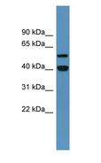 DDB2 Antibody - DDB2 antibody Western Blot of Human Placenta.  This image was taken for the unconjugated form of this product. Other forms have not been tested.