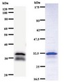DDB2 Antibody - Western blot of immunized recombinant protein using DDB2 antibody. Left: DDB2 staining. Right: Coomassie Blue staining of immunized recombinant protein.