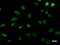 DDB2 Antibody - Immunostaining analysis in HeLa cells. HeLa cells were fixed with 4% paraformaldehyde and permeabilized with 0.1% Triton X-100 in PBS. The cells were immunostained with anti-DDB2 mAb.