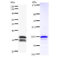 DDB2 Antibody - Left : Western blot analysis of immunized recombinant protein, using anti-DDB2 monoclonal antibody. Right : CBB staining of immunized recombinant protein.