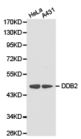 DDB2 Antibody - Western blot of extracts of various cell lines, using DDB2 antibody.