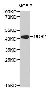 DDB2 Antibody - Western blot analysis of extracts of MCF-7 cell line, using DDB2 antibody.
