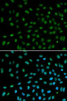 DDB2 Antibody - Immunofluorescence analysis of MCF7 cell using DDB2 antibody. Blue: DAPI for nuclear staining.