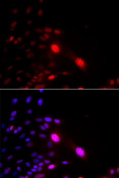 DDB2 Antibody - Immunofluorescence analysis of U2OS cells.
