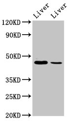 DDB2 Antibody - Positive Western Blot detected in Mouse liver tissue, Rat liver tissue. All lanes: DDB2 antibody at 4.9 µg/ml Secondary Goat polyclonal to rabbit IgG at 1/50000 dilution. Predicted band size: 48, 27, 18, 41 KDa. Observed band size: 48 KDa