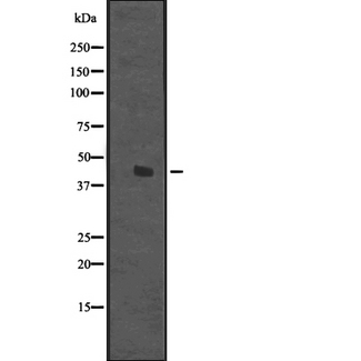 DDB2 Antibody - Western blot analysis of DDB2 expression in HeLa cells lysate. The lane on the left is treated with the antigen-specific peptide.