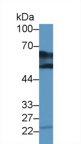 DDC / DOPA Decarboxylase Antibody - Western Blot; Sample: Bovine Kidney lysate; Primary Ab: 2µg/ml Rabbit Anti-Human DDC Antibody Second Ab: 0.2µg/mL HRP-Linked Caprine Anti-Rabbit IgG Polyclonal Antibody