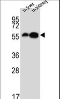 DDC / DOPA Decarboxylase Antibody - DDC Antibody western blot of mouse liver,kidney tissue lysates (15 ug/lane). The DDC antibody detected DDC protein (arrow).