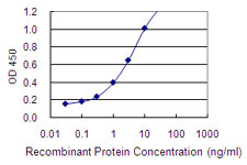 DDC / DOPA Decarboxylase Antibody - Detection limit for recombinant GST tagged DDC is 0.03 ng/ml as a capture antibody.