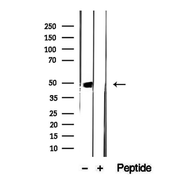 DDC / DOPA Decarboxylase Antibody - Western blot analysis of extracts of mouse kidney tissue using DOPA decarboxylase antibody.