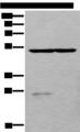 DDC / DOPA Decarboxylase Antibody - Western blot analysis of Human left kidney tissue and Human fetal liver tissue lysates  using DDC Polyclonal Antibody at dilution of 1:800