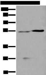 DDC / DOPA Decarboxylase Antibody - Western blot analysis of Human left kidney tissue and Human fetal liver tissue lysates  using DDC Polyclonal Antibody at dilution of 1:400