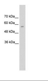 DDC / DOPA Decarboxylase Antibody - HepG2 Cell Lysate.  This image was taken for the unconjugated form of this product. Other forms have not been tested.