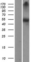 DDC / DOPA Decarboxylase Protein - Western validation with an anti-DDK antibody * L: Control HEK293 lysate R: Over-expression lysate
