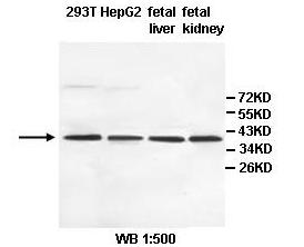 DDH / AKR1C1 Antibody
