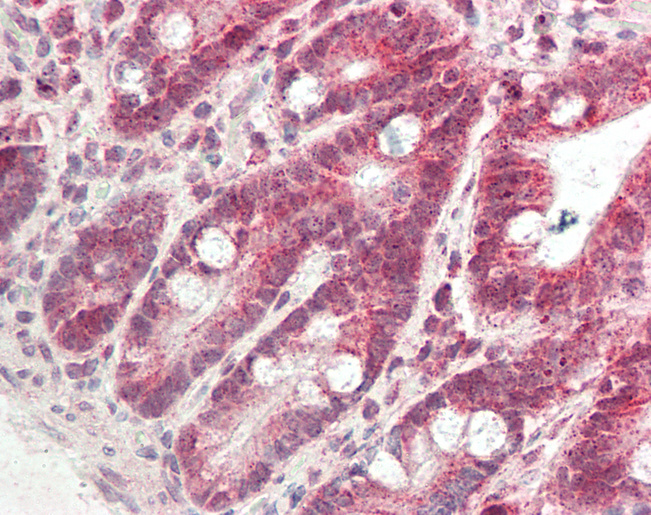 DDH / AKR1C1 Antibody - Human Small Intestine: Formalin-Fixed, Paraffin-Embedded (FFPE).  This image was taken for the unconjugated form of this product. Other forms have not been tested.