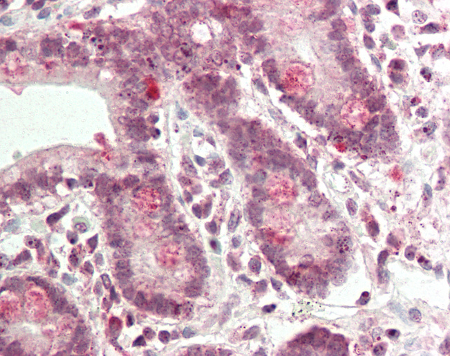 DDH / AKR1C1 Antibody - Human Small Intestine: Formalin-Fixed, Paraffin-Embedded (FFPE).  This image was taken for the unconjugated form of this product. Other forms have not been tested.