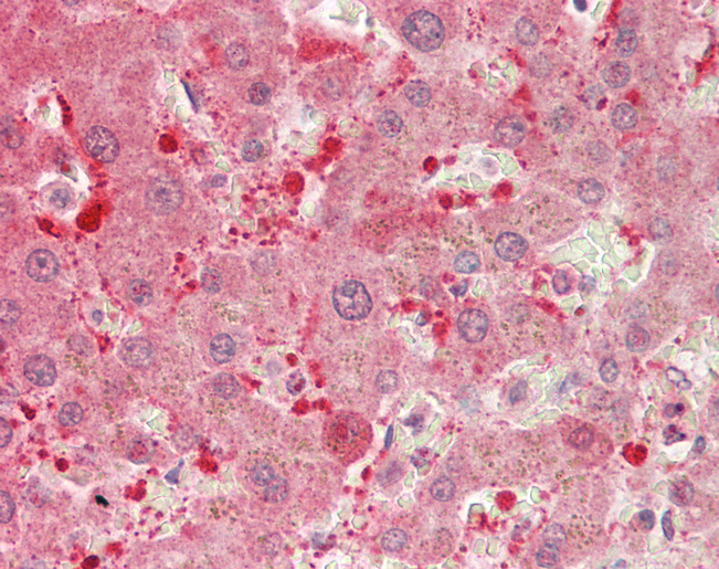 DDH / AKR1C1 Antibody - Human Liver: Formalin-Fixed, Paraffin-Embedded (FFPE).  This image was taken for the unconjugated form of this product. Other forms have not been tested.