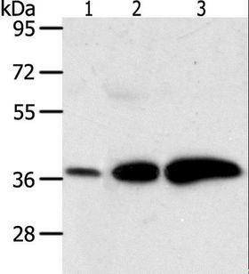 DDH / AKR1C1 Antibody - Western blot analysis of Human liver cancer and breast infiltrative duct tissue, human fetal brain tissue, using AKR1C1 Polyclonal Antibody at dilution of 1:500.