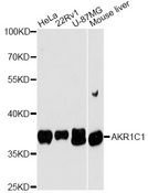 DDH / AKR1C1 Antibody - Western blot analysis of extracts of various cell lines, using AKR1C1 antibody at 1:3000 dilution. The secondary antibody used was an HRP Goat Anti-Rabbit IgG (H+L) at 1:10000 dilution. Lysates were loaded 25ug per lane and 3% nonfat dry milk in TBST was used for blocking. An ECL Kit was used for detection and the exposure time was 90s.