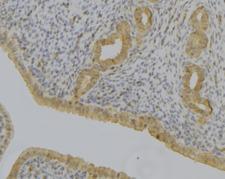 DDH / AKR1C1 Antibody - 1:100 staining human uterus tissue by IHC-P. The sample was formaldehyde fixed and a heat mediated antigen retrieval step in citrate buffer was performed. The sample was then blocked and incubated with the antibody for 1.5 hours at 22°C. An HRP conjugated goat anti-rabbit antibody was used as the secondary.