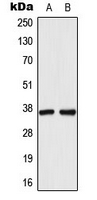 DDH / AKR1C1 Antibody - Western blot analysis of AKR1C1 expression in HeLa (A); HepG2 (B) whole cell lysates.