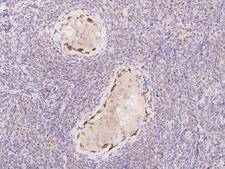 DDHD1 Antibody - Immunochemical staining of human DDHD1 in human testis with rabbit polyclonal antibody at 1:100 dilution, formalin-fixed paraffin embedded sections.