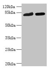 DDHD2 Antibody - Western blot All lanes: DDHD2 antibody at 10µg/ml Lane 1: K562 whole cell lysate Lane 2: U251 whole cell lysate Secondary Goat polyclonal to rabbit IgG at 1/10000 dilution Predicted band size: 82, 38 kDa Observed band size: 82 kDa