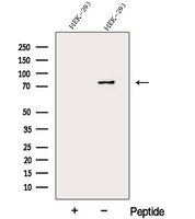 DDHD2 Antibody - Western blot analysis of extracts of COS-7 cells using DDHD2 antibody. The lane on the left was treated with blocking peptide.