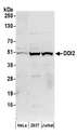 DDI2 Antibody - Detection of human DDI2 by western blot. Samples: Whole cell lysate (50 µg) from HeLa, HEK293T, and Jurkat cells prepared using NETN lysis buffer. Antibodies: Affinity purified rabbit anti-DDI2 antibody used for WB at 0.1 µg/ml. Detection: Chemiluminescence with an exposure time of 3 minutes.