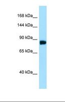 DDIAS Antibody - Western blot of Human HepG2. C11orf82 antibody dilution 1.0 ug/ml.  This image was taken for the unconjugated form of this product. Other forms have not been tested.
