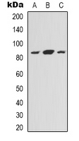 DDIAS Antibody - Western blot analysis of NOXIN expression in HEK293T (A); HeLa (B); HepG2 (C) whole cell lysates.