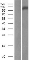 DDIAS Protein - Western validation with an anti-DDK antibody * L: Control HEK293 lysate R: Over-expression lysate