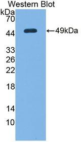 DDIT3 / CHOP Antibody - Western blot of DDIT3 / CHOP antibody.