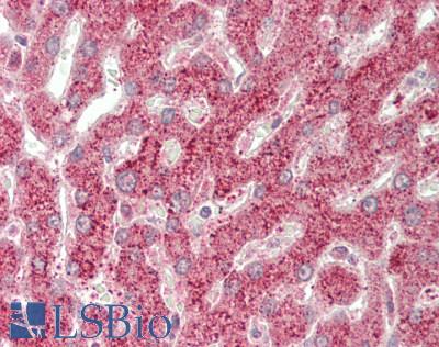 DDIT3 / CHOP Antibody - Human Liver: Formalin-Fixed, Paraffin-Embedded (FFPE).  This image was taken for the unconjugated form of this product. Other forms have not been tested.