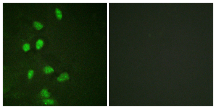 DDIT3 / CHOP Antibody - Immunofluorescence analysis of HeLa cells, using CHOP Antibody. The picture on the right is blocked with the synthesized peptide.
