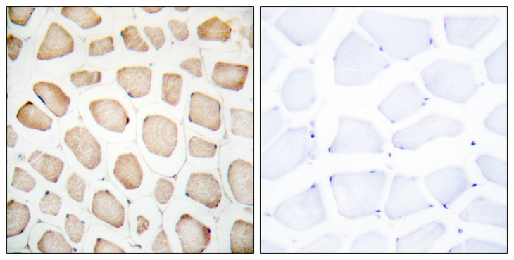 DDIT3 / CHOP Antibody - Immunohistochemistry analysis of paraffin-embedded human skeletal muscle tissue, using CHOP Antibody. The picture on the right is blocked with the synthesized peptide.