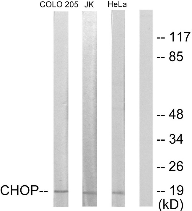 DDIT3 / CHOP Antibody - Western blot analysis of lysates from HeLa, Jurkat, and COLO205 cells, using CHOP Antibody. The lane on the right is blocked with the synthesized peptide.