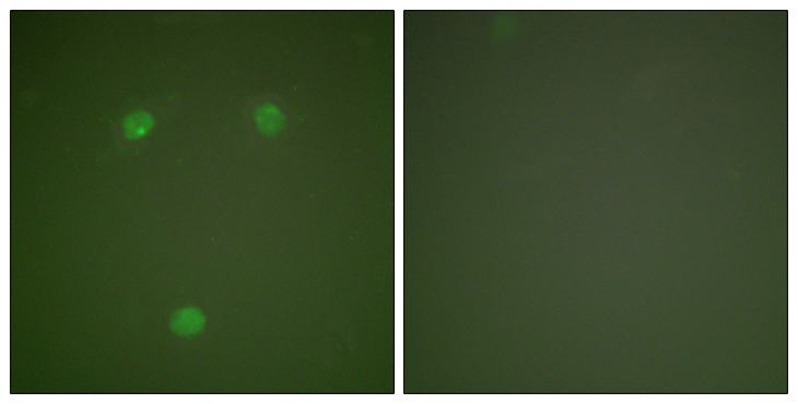 DDIT3 / CHOP Antibody - Immunofluorescence analysis of COS7 cells, using GADD153 Antibody. The picture on the right is blocked with the synthesized peptide.