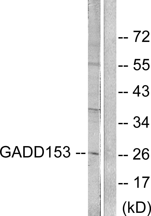DDIT3 / CHOP Antibody - Western blot analysis of lysates from LOVO cells, treated with serum 10% 15', using GADD153 Antibody. The lane on the right is blocked with the synthesized peptide.