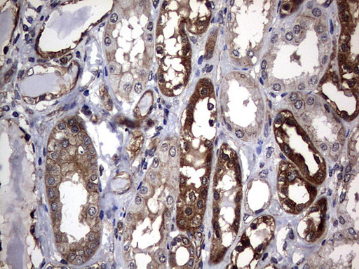 DDIT3 / CHOP Antibody - IHC of paraffin-embedded Human Kidney tissue using anti-DDIT3 mouse monoclonal antibody. (Heat-induced epitope retrieval by 1 mM EDTA in 10mM Tris, pH8.5, 120°C for 3min).