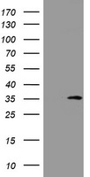 DDIT3 / CHOP Antibody - HEK293T cells were transfected with the pCMV6-ENTRY control (Left lane) or pCMV6-ENTRY DDIT3 (Right lane) cDNA for 48 hrs and lysed. Equivalent amounts of cell lysates (5 ug per lane) were separated by SDS-PAGE and immunoblotted with anti-DDIT3.