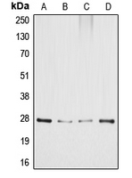 DDIT3 / CHOP Antibody - Western blot analysis of GADD153 expression in HeLa (A); MCF7 (B); SP2/0 (C); PC12 (D) whole cell lysates.