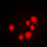 DDIT3 / CHOP Antibody - Immunofluorescent analysis of GADD153 staining in MCF7 cells. Formalin-fixed cells were permeabilized with 0.1% Triton X-100 in TBS for 5-10 minutes and blocked with 3% BSA-PBS for 30 minutes at room temperature. Cells were probed with the primary antibody in 3% BSA-PBS and incubated overnight at 4 C in a humidified chamber. Cells were washed with PBST and incubated with a DyLight 594-conjugated secondary antibody (red) in PBS at room temperature in the dark. DAPI was used to stain the cell nuclei (blue).