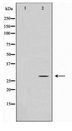 DDIT3 / CHOP Antibody - Western blot of Jurkat cell lysate using GADD153 Antibody