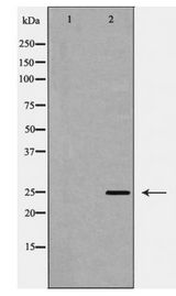 DDIT3 / CHOP Antibody - Western blot of CHOP expression in Jurkat cell lysate