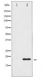 DDIT3 / CHOP Antibody - Western blot of CHOP expression in HeLa whole cell lysates,The lane on the left is treated with the antigen-specific peptide.