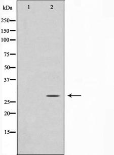DDIT3 / CHOP Antibody - Western blot analysis on Jurkat cell lysates using GADD153 antibody. The lane on the left is treated with the antigen-specific peptide.