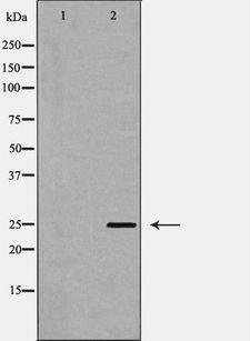 DDIT3 / CHOP Antibody - Western blot analysis of CHOP expression in Jurkat cells lysate. The lane on the left is treated with the antigen-specific peptide.